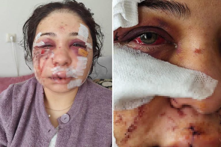 Şiddet gören kadına da hapis cezası! “Yok artık” dedirten karar
